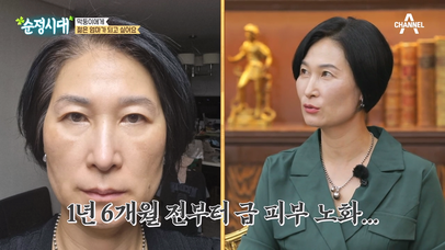 ＂젊은 엄마가 되고 싶어요＂ 하지만 현실은 노화 진행 중? | 네이트 TV